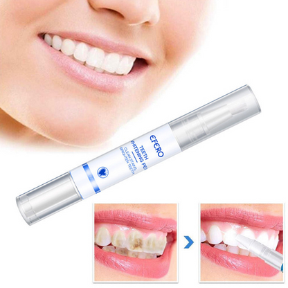 Smiley™ - Éclaircissant Dentaire (Promotion)