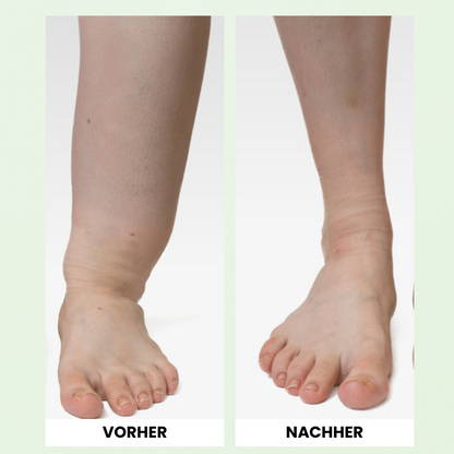 OrthoMax® Thérapie Lymphatique