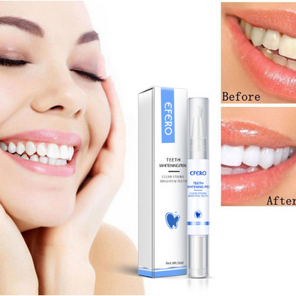 Smiley™ - Éclaircissant Dentaire (Promotion)